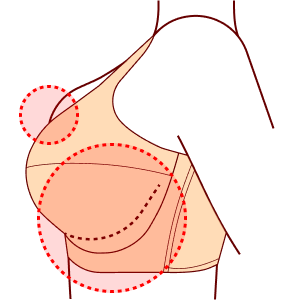 Между косточками чашечек бюстгальтера и нижней частью груди остается пространство